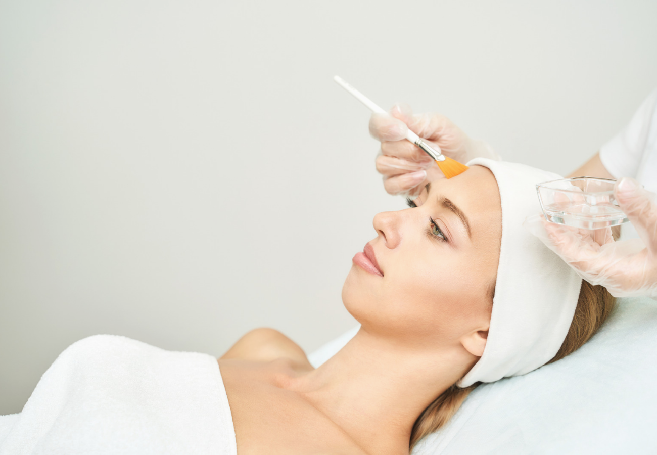 pigmentové skvrny a chemický peeling