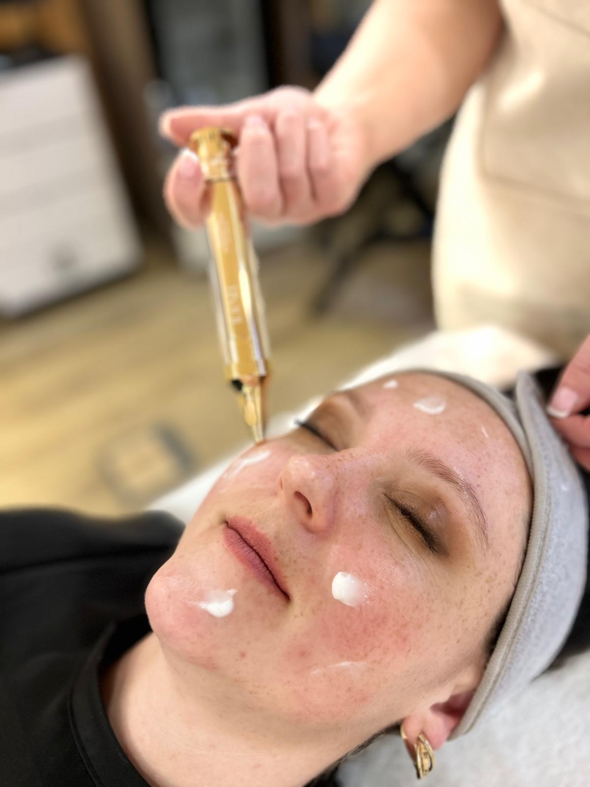 Obrázek: Kosmetické ošetření Studio Helena Jihlava Idenel zlatá jehla